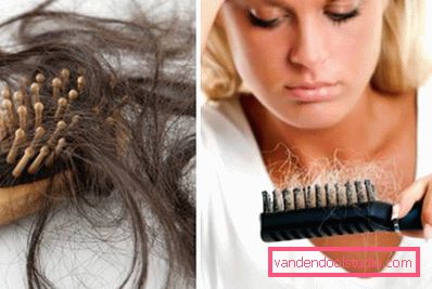 hair loss problem hair loss problem