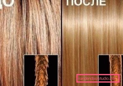 hairs before and after the procedure