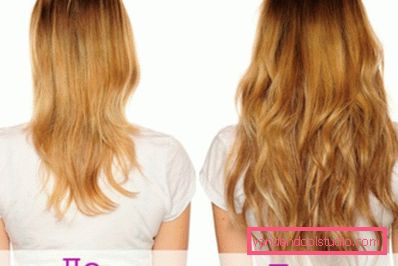 Before and after Before and after