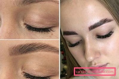 before and after before and after