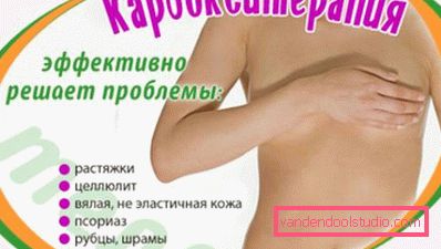 body carboxytherapy