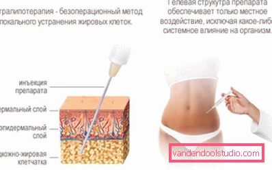 information about intralipotherapy