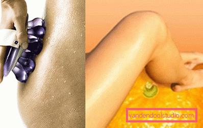 anti-cellulite massage massager and the result of it anti-cellulite massage massager and the result of it