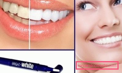 gorgeous hollywood smile gorgeous hollywood smile