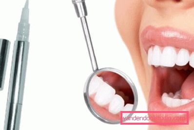 snow white teeth snow white teeth