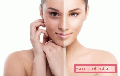 facial skin before and after cleansing sessions facial skin before and after cleansing sessions