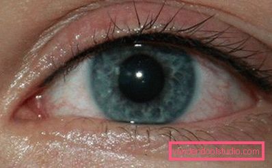 eye