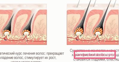 Hair mesotherapy