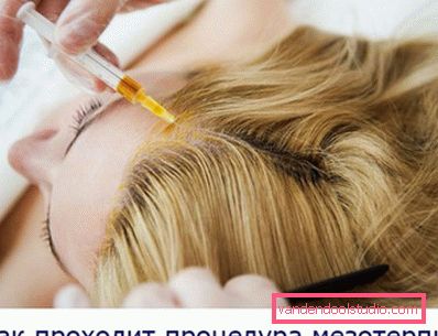Hair mesotherapy