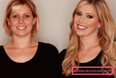blonde after the procedure blonde after the procedure