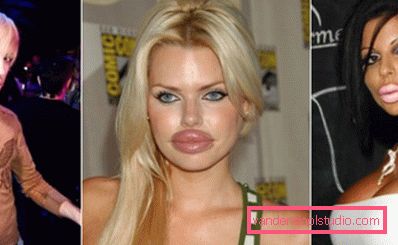 possible effects of botox in the lips