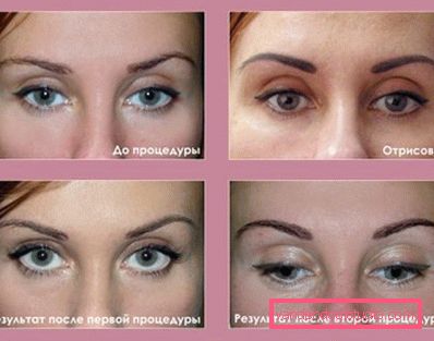 before and after the eyebrow permanent procedure