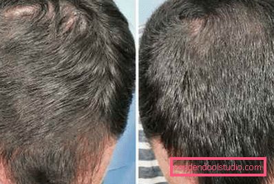 on men's hair on men's hair