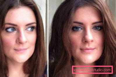 Before and after