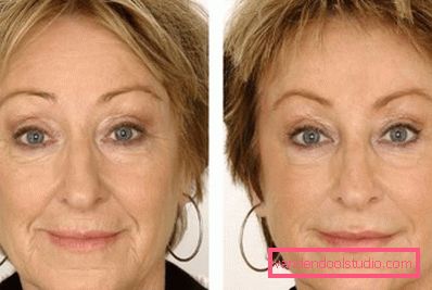 effect on the face effect on the face