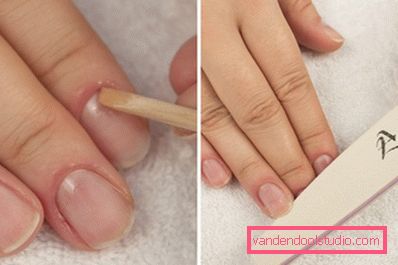 Nail surface treatment