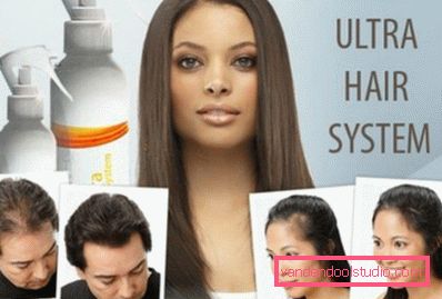 alopecia treatment alopecia treatment