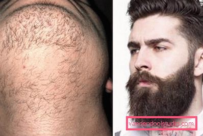 beard beard