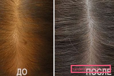 before and after before and after
