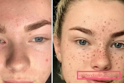 before and after before and after