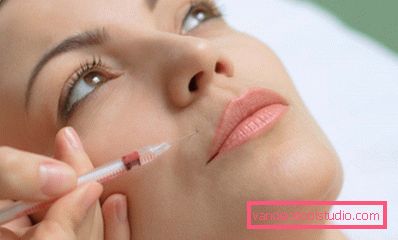 hyaluronke injection hyaluronke injection